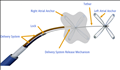 Septal Wall Closure Device