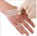 Wound Closure Strips